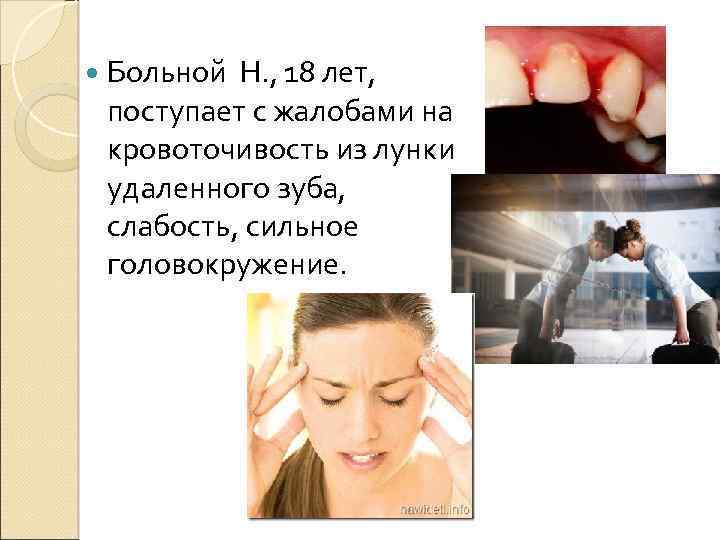 Слабость в зубах. Особенности удаления зубов у больных гемофилией. Удаление зуба у пациента с гемофилией. Гемофилия жалобы пациента. Задание про больного с гемофилией.