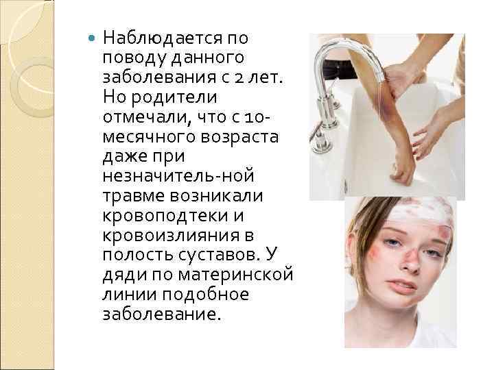  Наблюдается по поводу данного заболевания с 2 лет. Но родители отмечали, что с