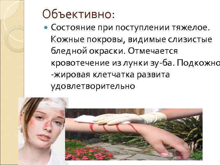 Объективно: Состояние при поступлении тяжелое. Кожные покровы, видимые слизистые бледной окраски. Отмечается кровотечение из