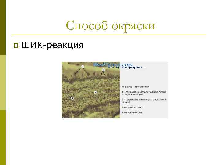 Способ окраски p ШИК-реакция 