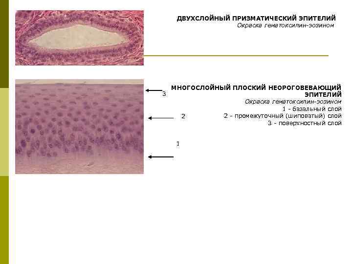 Многослойный плоский неороговевающий эпителий особенности