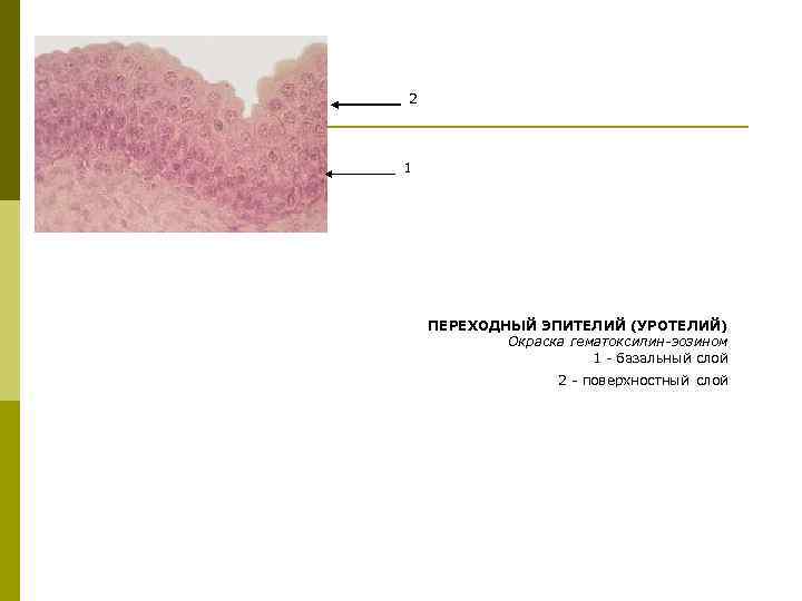 2 1 ПЕРЕХОДНЫЙ ЭПИТЕЛИЙ (УРОТЕЛИЙ) Окраска гематоксилин-эозином 1 - базальный слой 2 - поверхностный