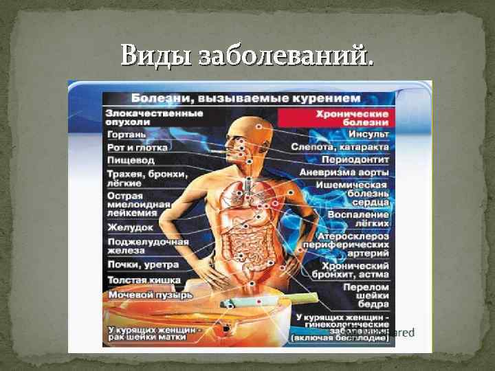 Виды заболеваний. 