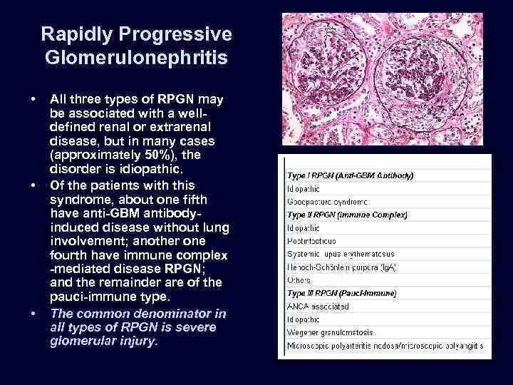 Rapidly Progressive Glomerulonephritis • • • All three types of RPGN may be associated