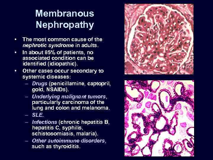 RENAL PATHOLOGY Greg Balko MD May 27