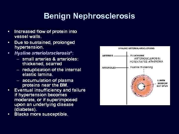 Benign Nephrosclerosis • • • Increased flow of protein into vessel walls. Due to