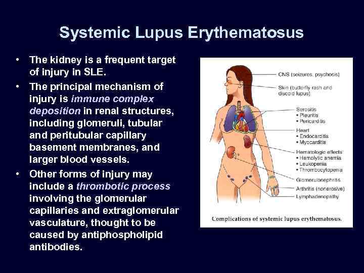 Systemic Lupus Erythematosus • The kidney is a frequent target of injury in SLE.