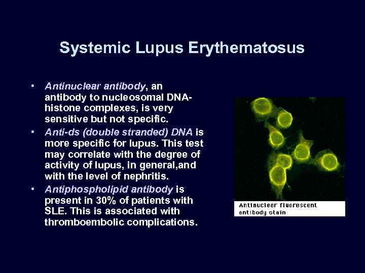Systemic Lupus Erythematosus • Antinuclear antibody, an antibody to nucleosomal DNAhistone complexes, is very