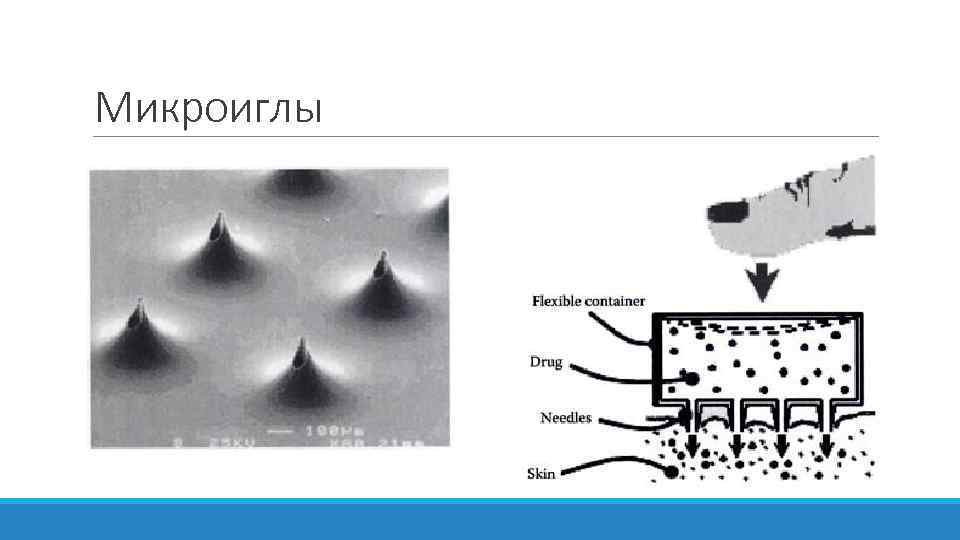 Микроиглы 