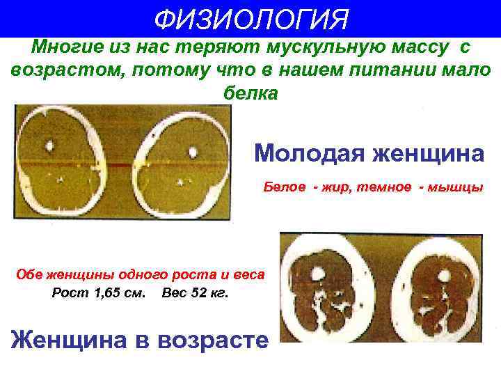 ФИЗИОЛОГИЯ Многие из нас теряют мускульную массу с возрастом, потому что в нашем питании