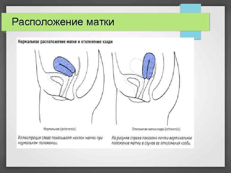 Расположение матки 