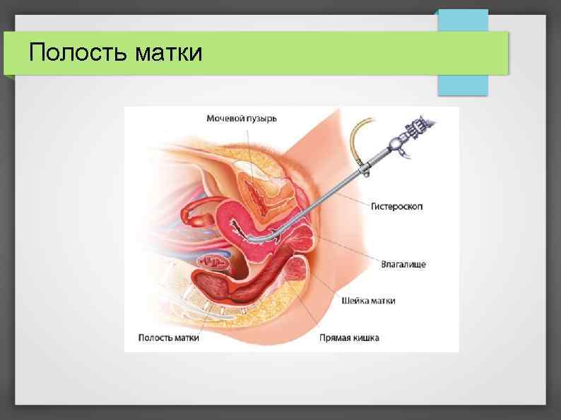 Строение шейки матки в картинках