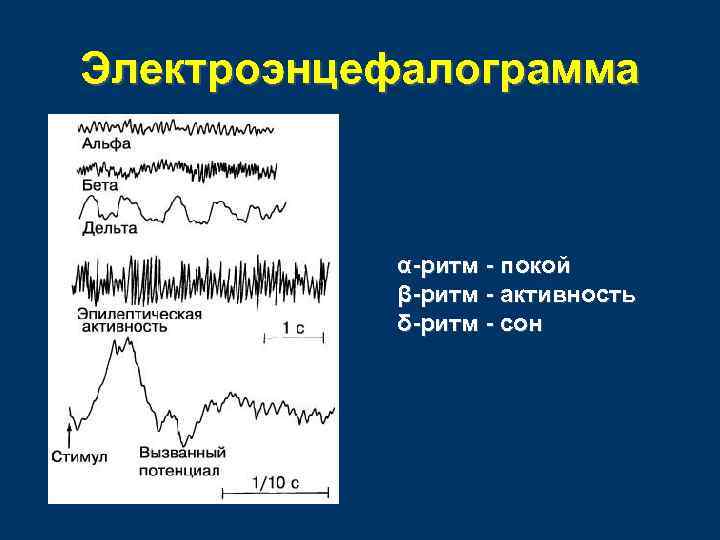 Электроэнцефалограмма α-ритм - покой β-ритм - активность δ-ритм - сон 