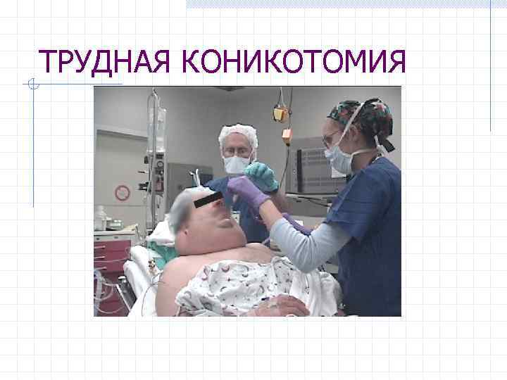 ТРУДНАЯ КОНИКОТОМИЯ 