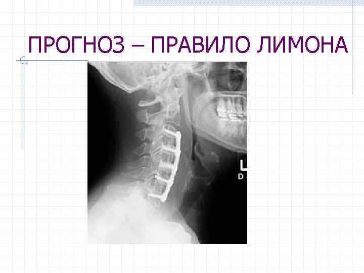 ПРОГНОЗ – ПРАВИЛО ЛИМОНА 