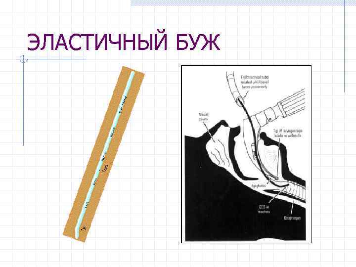 ЭЛАСТИЧНЫЙ БУЖ 