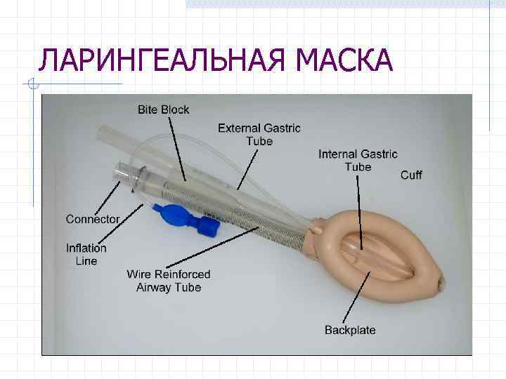 ЛАРИНГЕАЛЬНАЯ МАСКА 