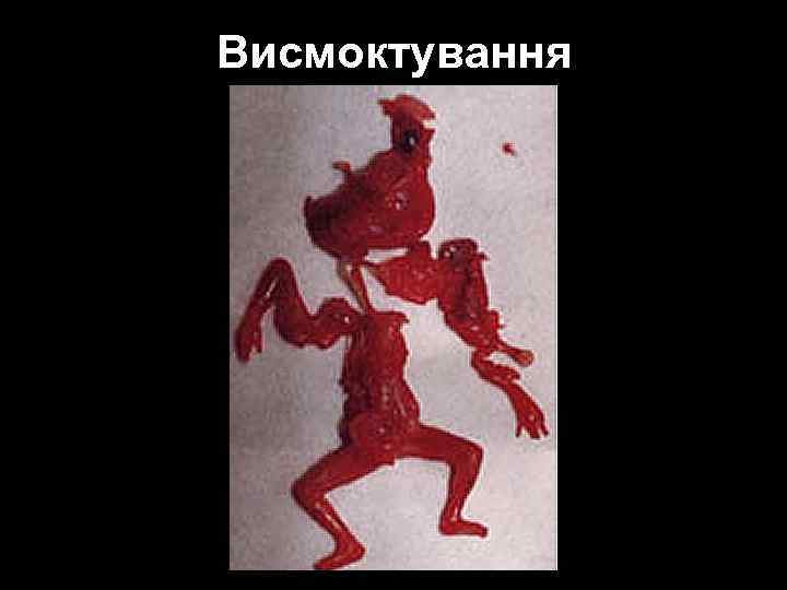 Висмоктування 