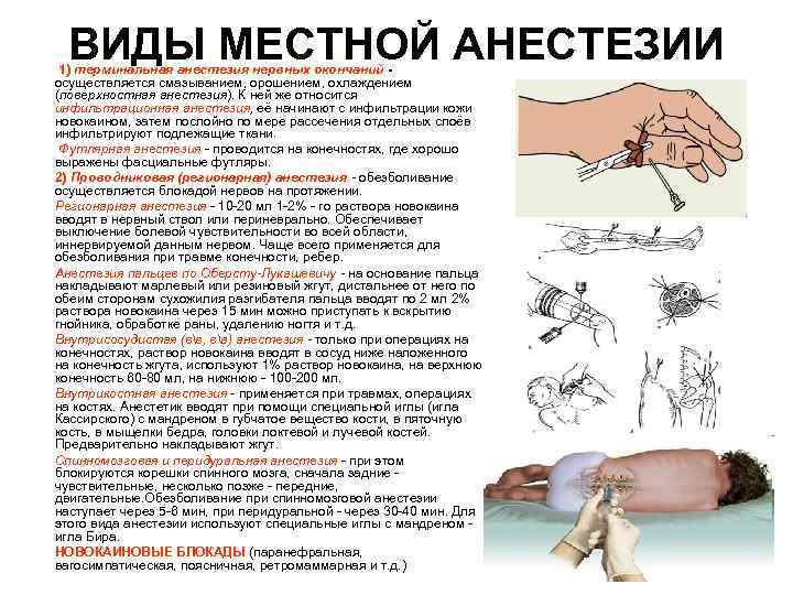 Местная анестезия картинки