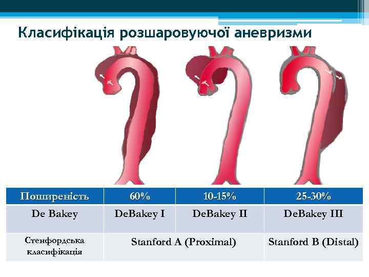 Класифікація розшаровуючої аневризми Поширеність De Bakey Стенфордська класифікація 60% De. Bakey I 10 -15%