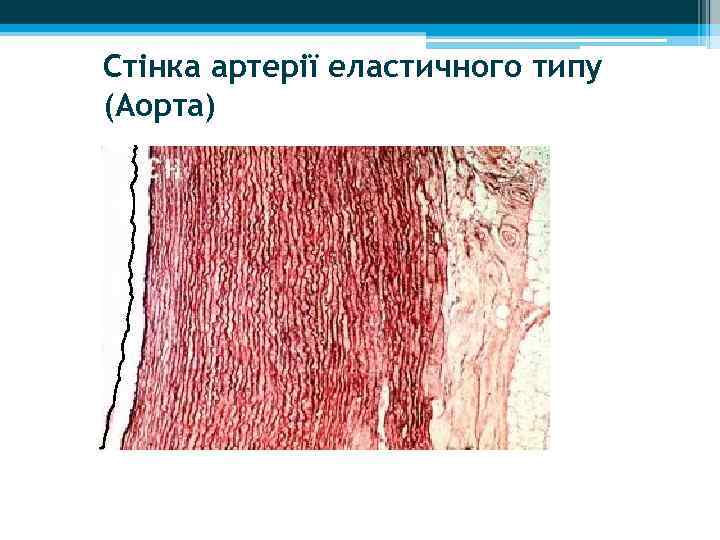Стінка артерії еластичного типу (Аорта) 