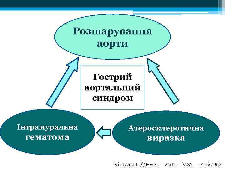 Розшарування аорти Гострий аортальний синдром Інтрамуральна гематома Атеросклеротична виразка Vilacosta I. //Heart. – 2001.