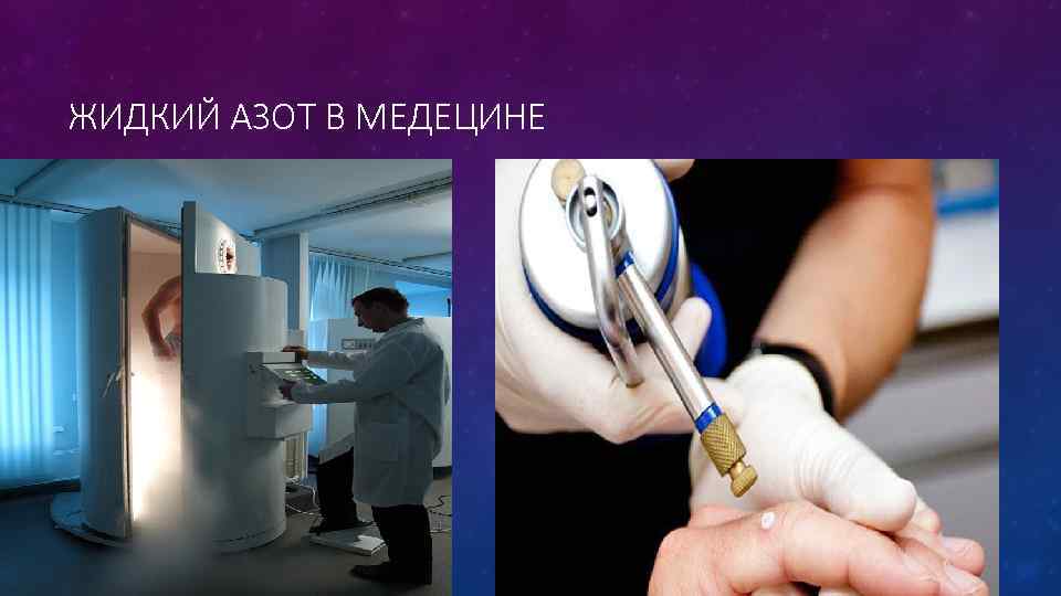 ЖИДКИЙ АЗОТ В МЕДЕЦИНЕ 