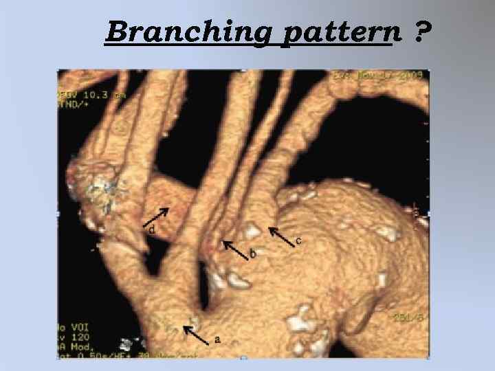 Branching pattern ? 