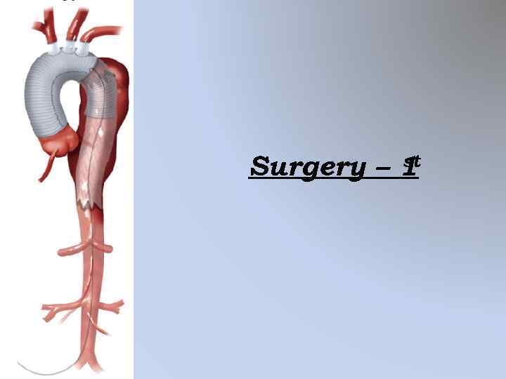st Surgery – 1 
