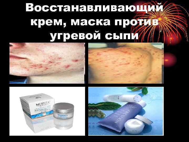 Восстанавливающий крем, маска против угревой сыпи 