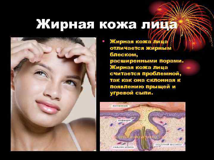 Жирная кожа лица • Жирная кожа лица отличается жирным блеском, расширенными порами. Жирная кожа