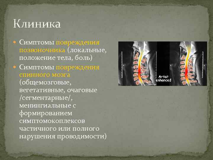 Клиника Симптомы повреждения позвоночника (локальные, положение тела, боль) Симптомы повреждения спинного мозга (общемозговые, вегетативные,