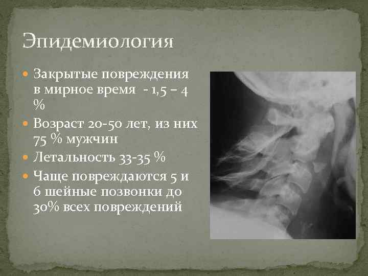 Эпидемиология Закрытые повреждения в мирное время - 1, 5 – 4 % Возраст 20