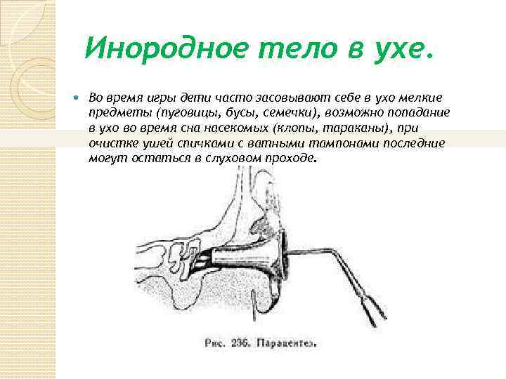 Презентация инородные тела глотки