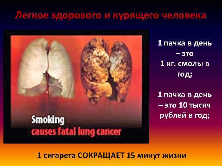 Легкое здорового и курящего человека 1 пачка в день – это 1 кг. смолы