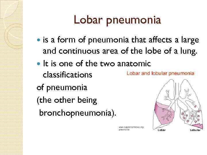 Lobar pneumonia is a form of pneumonia that affects a large and continuous area