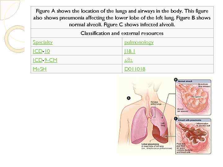 Figure A shows the location of the lungs and airways in the body. This
