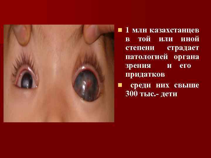 1 млн казахстанцев в той или иной степени страдает патологией органа зрения и его