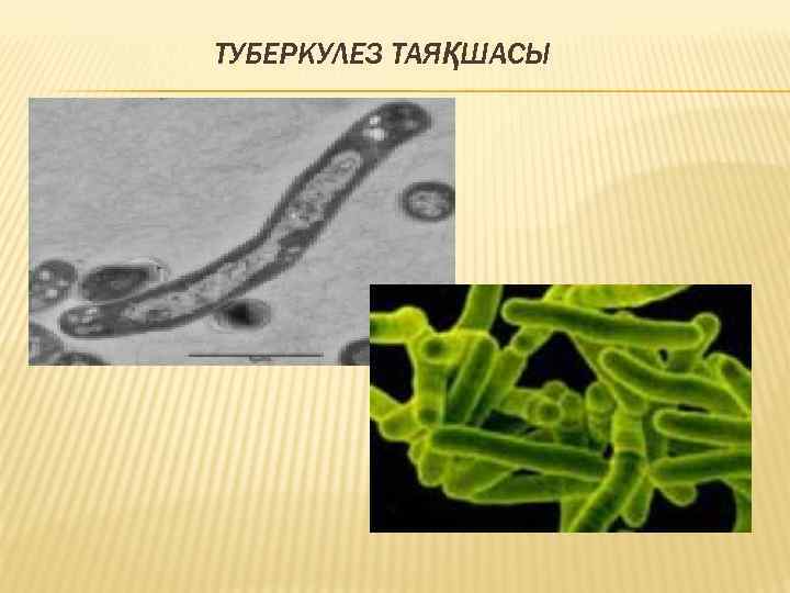 ТУБЕРКУЛЕЗ ТАЯҚШАСЫ 