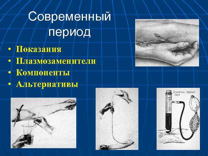 Современный период • • Показания Плазмозаменители Компоненты Альтернативы 