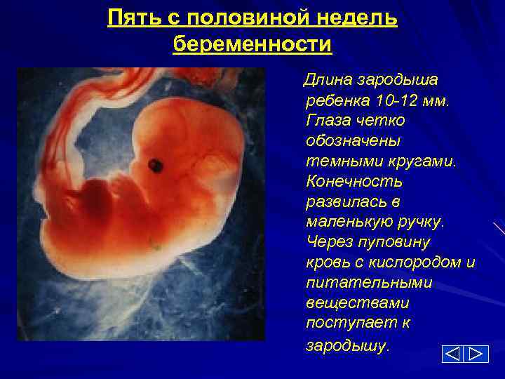 Пять с половиной недель беременности Длина зародыша ребенка 10 -12 мм. Глаза четко обозначены