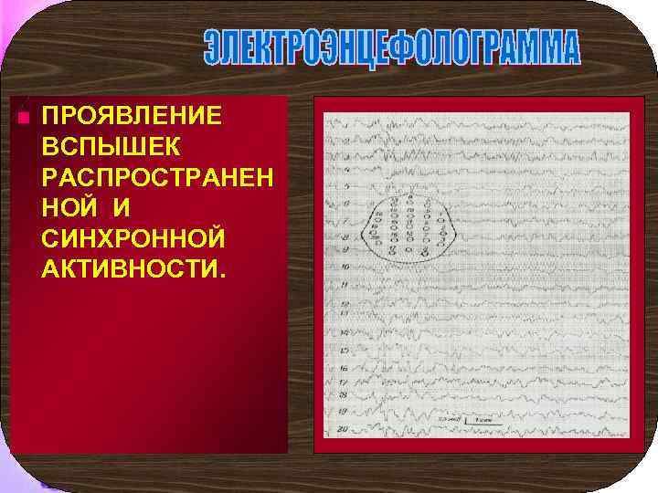 n ПРОЯВЛЕНИЕ ВСПЫШЕК РАСПРОСТРАНЕН НОЙ И СИНХРОННОЙ АКТИВНОСТИ. 