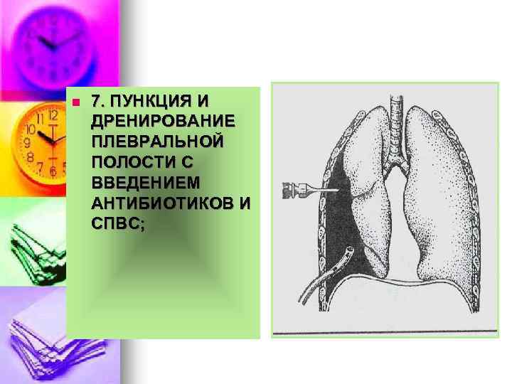 n 7. ПУНКЦИЯ И ДРЕНИРОВАНИЕ ПЛЕВРАЛЬНОЙ ПОЛОСТИ С ВВЕДЕНИЕМ АНТИБИОТИКОВ И СПВС; 