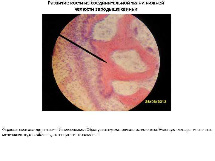 Развитие кости из соединительной ткани нижней челюсти зародыша свиньи Окраска гематоксилин + эозин. Из