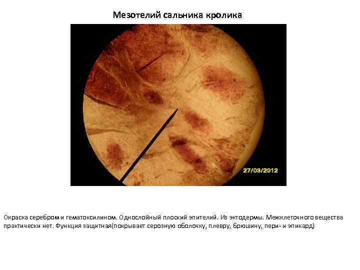 Мезотелий сальника кролика Окраска серебром и гематоксилином. Однослойный плоский эпителий. Из эктодермы. Межклеточного вещества