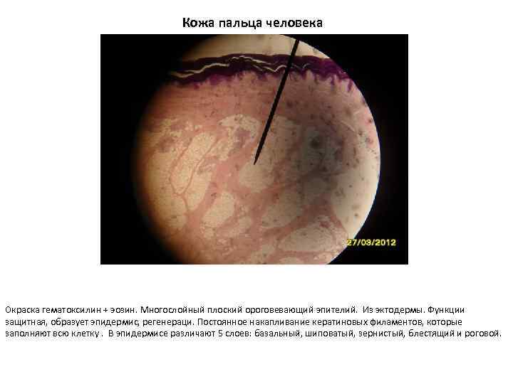 Кожа пальца человека Окраска гематоксилин + эозин. Многослойный плоский ороговевающий эпителий. Из эктодермы. Функции