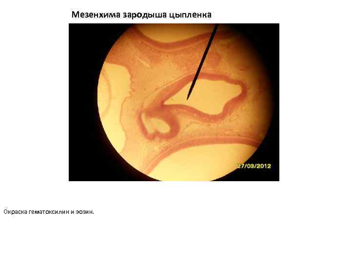 Мезенхима зародыша цыпленка Окраска гематоксилин и эозин. 