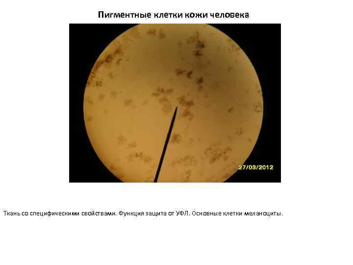 Пигментные клетки кожи человека Ткань со специфическими свойствами. Функция защита от УФЛ. Основные клетки