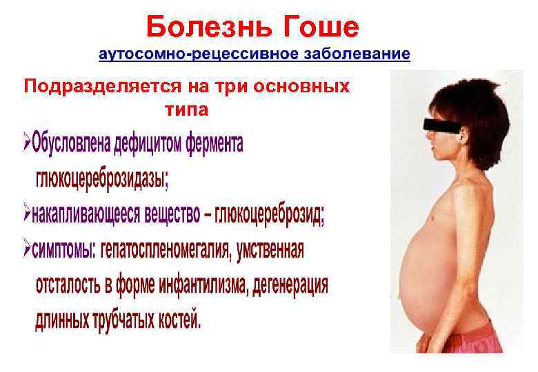 Болезнь Гоше Подразделяется на три основных типа 