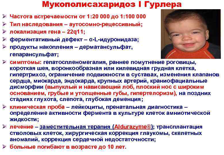 Мукополисахаридоз I Гурлера Ø Ø Ø Ø Ø Частота встречаемости от 1: 20 000